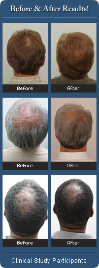 Before & After Pictures